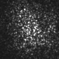 Speckle Pattern in Clotting Blood