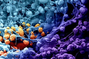 Innovative biomaterial