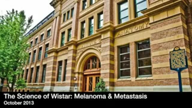 Phenotype Switching in Melanoma Cells