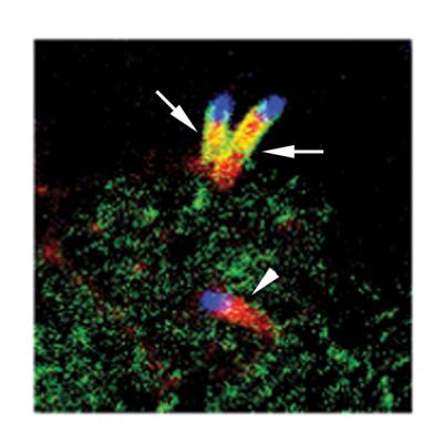Control of Protrusion Formation and Spreading by Listeria