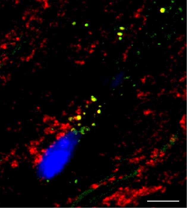 Esterified Cholesterol Transported by Lipoproteins Reaches the Heart’s Mitochondria and Disrupts Its Bioenergetics