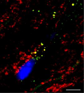 Esterified Cholesterol Transported by Lipoproteins Reaches the Heart’s Mitochondria and Disrupts Its Bioenergetics