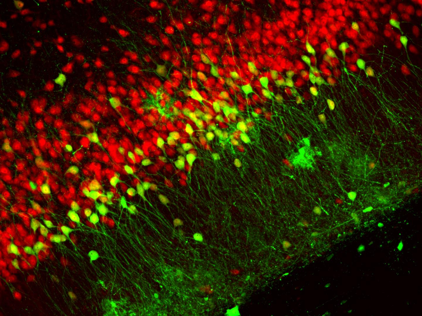 Physical Positioning Dramatically Enhances Brain Transduction After Intrathecal AAV9 Infusion (5-7)