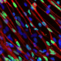 Skeletal Muscle