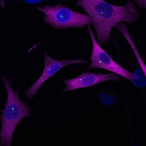 Melanoma cells