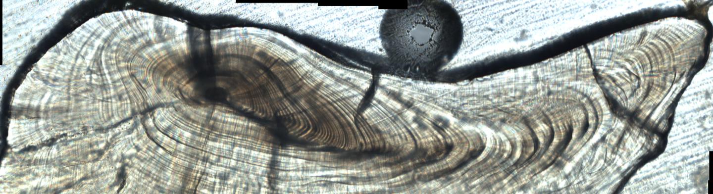 Otolith