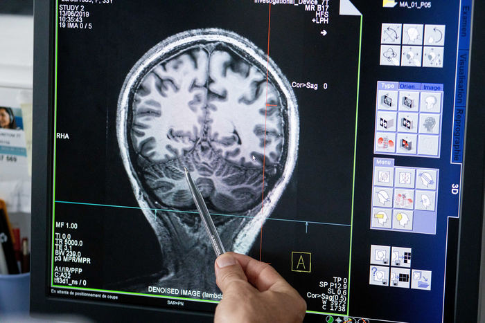MRI measurement