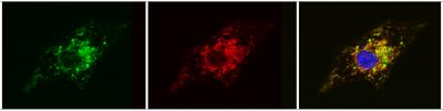 Modified RNA Transfection Corrects Barth Syndrome Dysfunction