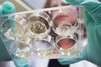 Hydrogels with Pancreatic Islet Cells