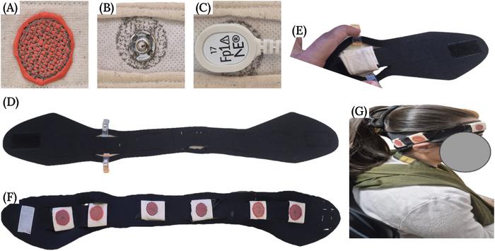 Design and validation of a modular smart headband with embroidered electrodes for comfortable EEG monitoring