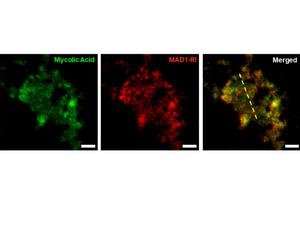 A triptych of microscope images that shows the binding of a host defense peptide