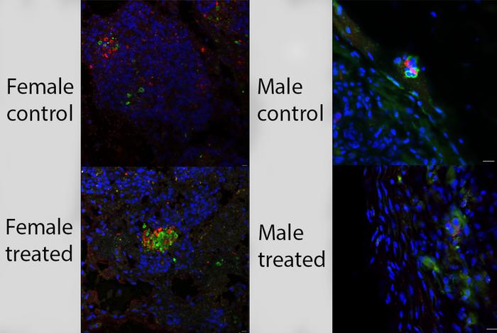 The immunofluorescent image shows human islet grafts that were pretreated with three small molecules (and controls for comparison) and transplanted into female or male mice.