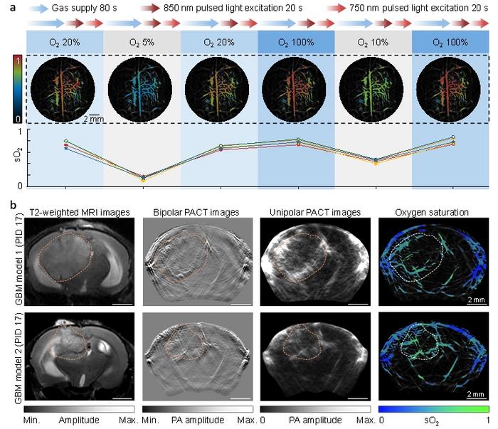 Figure 2 | In vivo whole-brain PACT functional imaging.