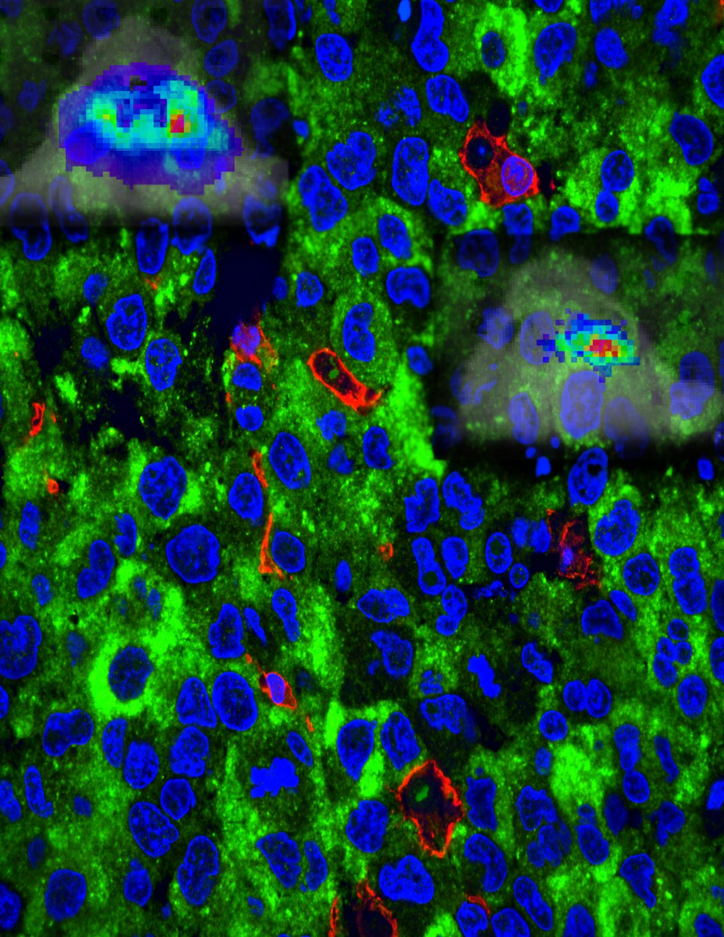 Inhibiting Cancer