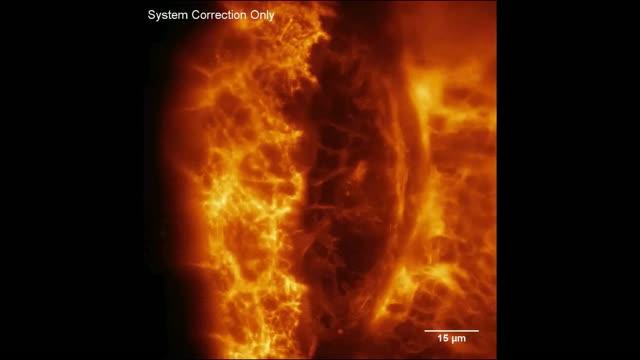Immune Cell