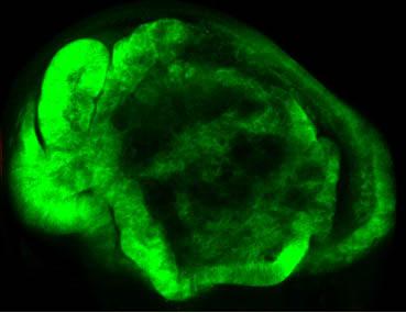 Drosophila Tumor