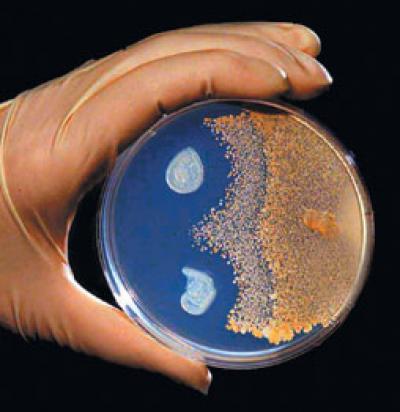 <i>bacillus</i>