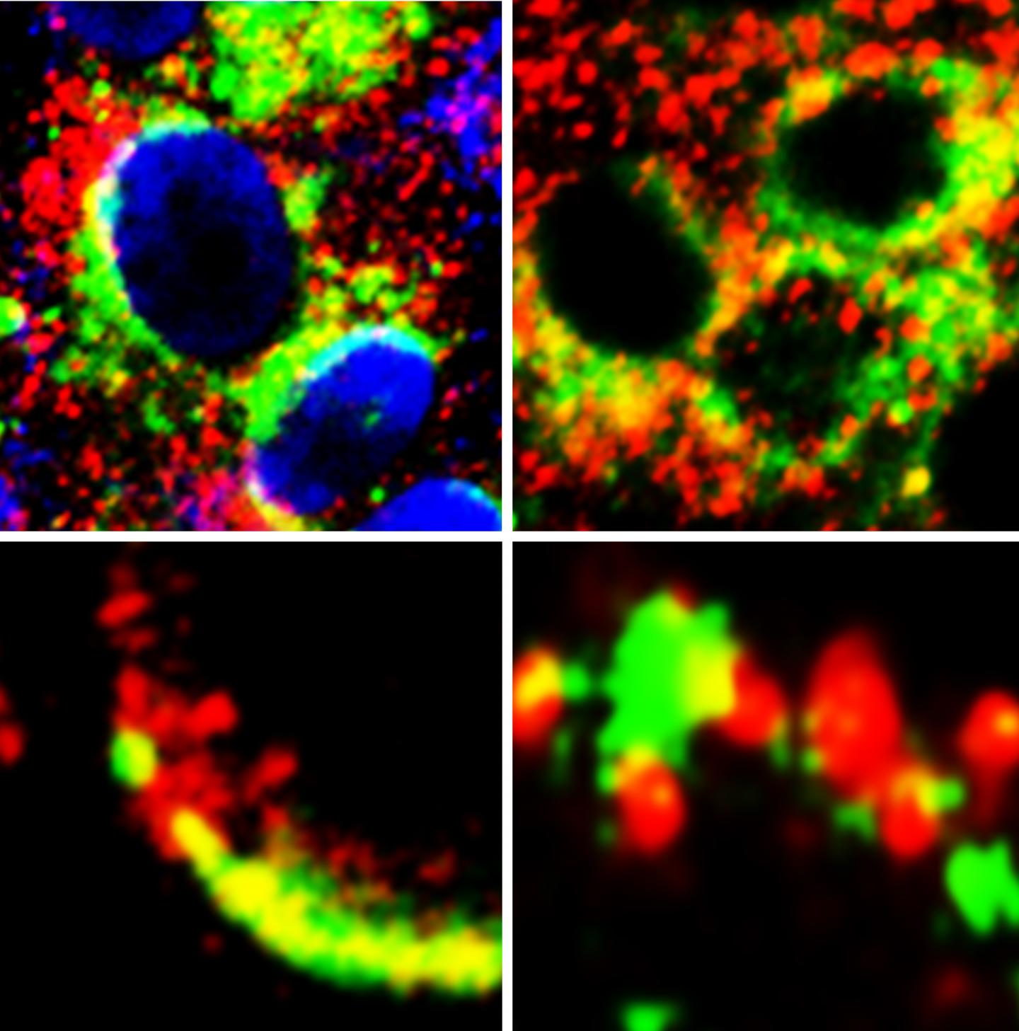 GRP78's Role in SARS-CoV-2 Infection