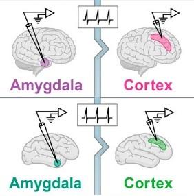 Human Brain