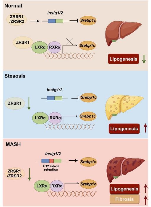 The Stage-Specific Functions of Minor Intron Splicing Factors during MASLD Progression