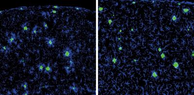 Unaltered A&beta; Pathology in the Presence of Peripherally Derived Myeloid Cells