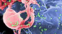 Biologists Deliver Neutralizing Antibodies that Protect Against HIV Infection in Mice
