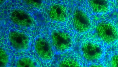 Gut Repair Glands