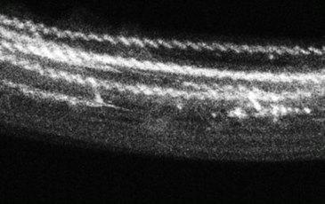 Strings of Atoms in Tellurim