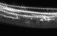 Strings of Atoms in Tellurim