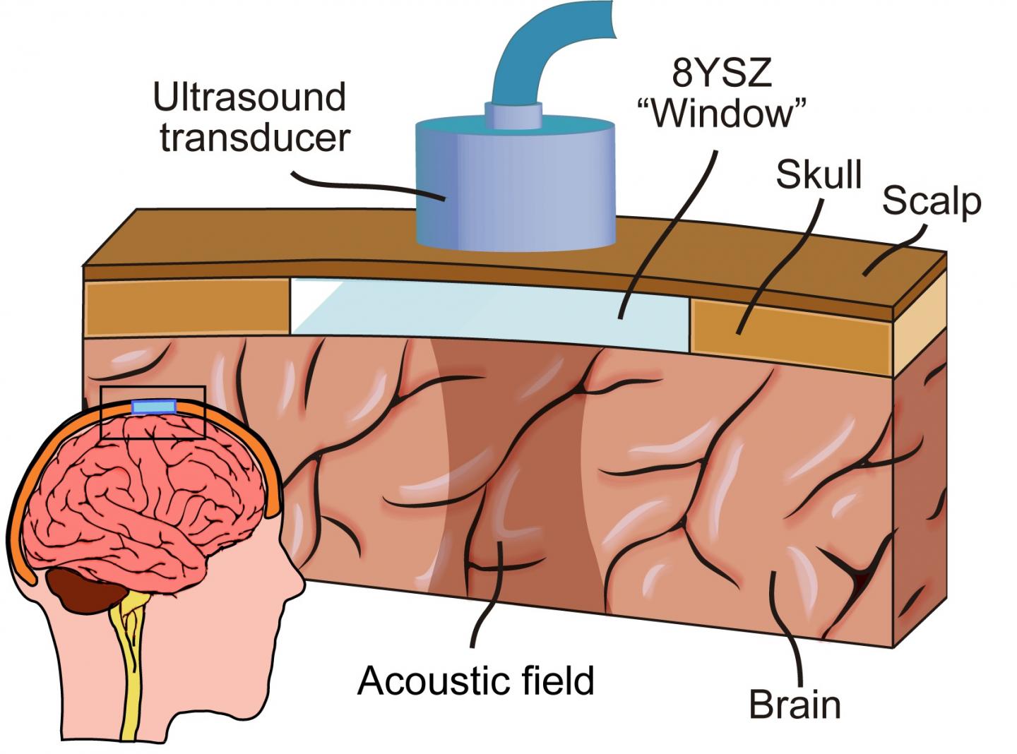 Window to the Brain Illustration