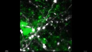 A look into the brain: microglia-neuron interaction