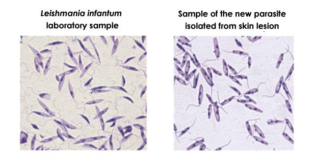 Pathogen Isolated in Brazilian Hospital