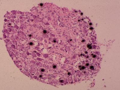 Neurons
