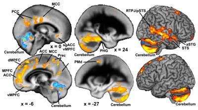Childhood Adversities and Brain Development