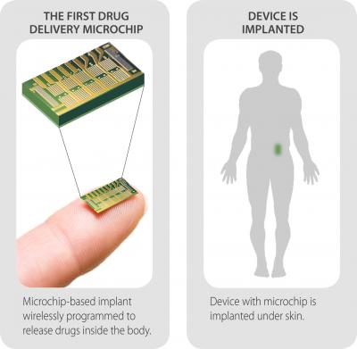 Implantable Microchip Delivers Osteoporosis Medicine (4 of 4)
