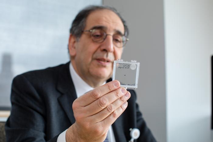 José-Alain Sahel, M.D., holding the PRIMA implant