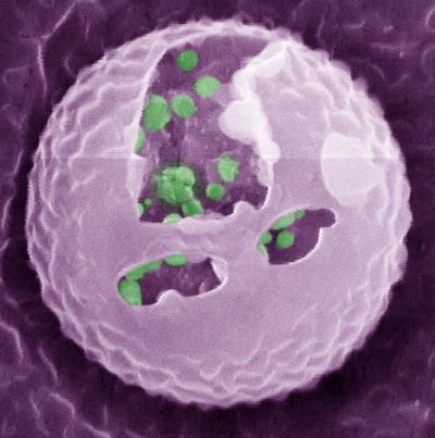 Zhen Gu, Artificial Beta Cell 2