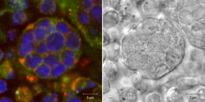 Thymic Nurse Cell
