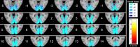 Figure 2 Series of Axial Section Images