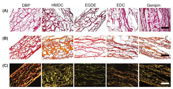 Histological Study of Intact and Cross-Linked Decellularized Bovine Pericardium