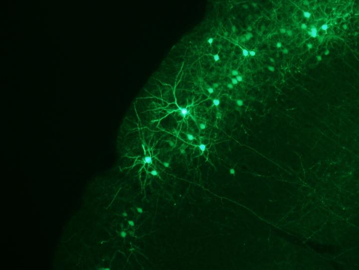 Neocortex to Computer Algorithms