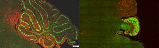 Cerebellum PTPMT1