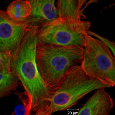 Thyroid Cancer Cell Line FTC-133