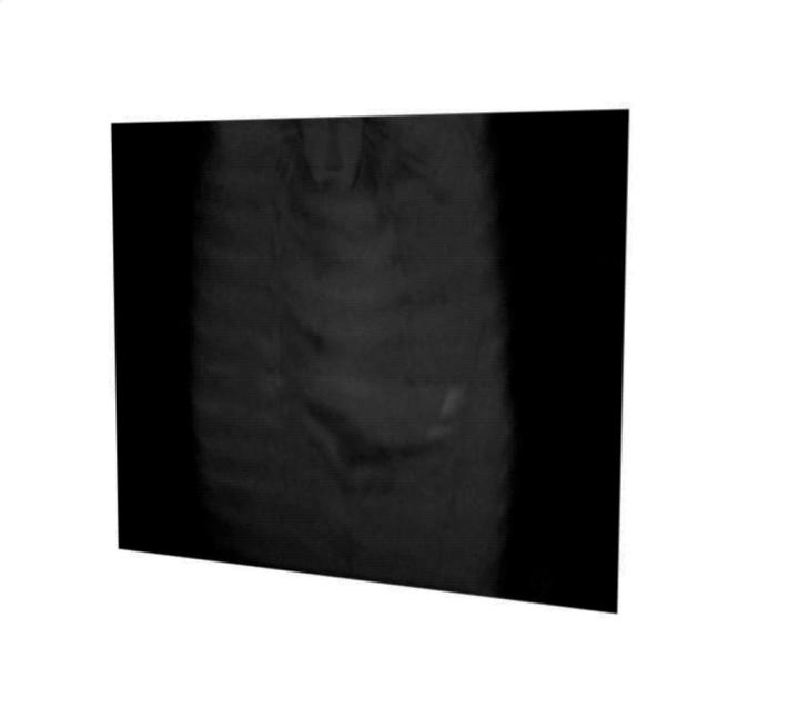 Reconstructing the Stomach from MRI Images