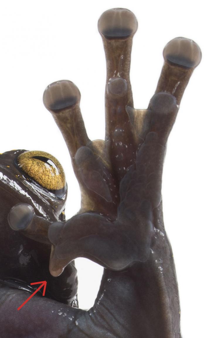 Hand Showing the Extraordinary Claw-Like Spine