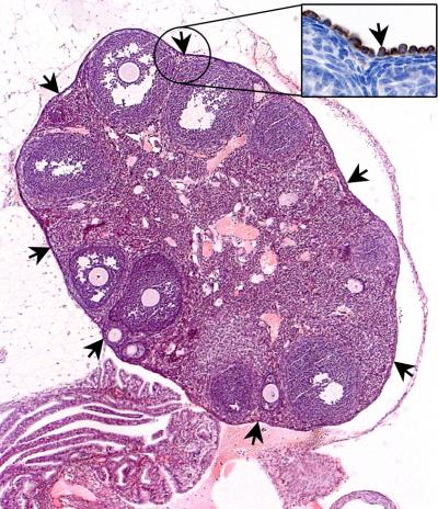 A*Star's IMB Finds Biomarker for Potential Early Detection of Ovarian Cancer