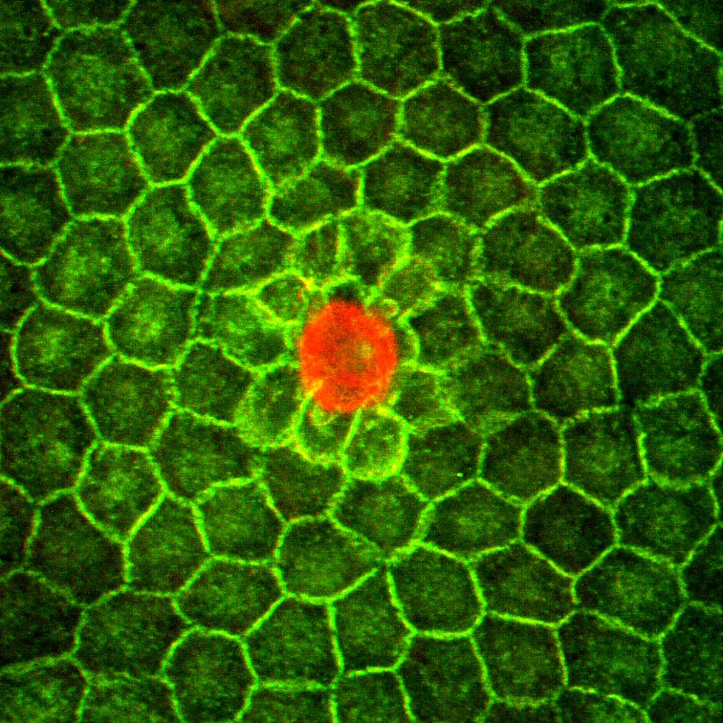 Competing Cells