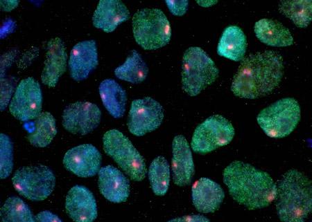 IPSC [IMAGE] | EurekAlert! Science News Releases