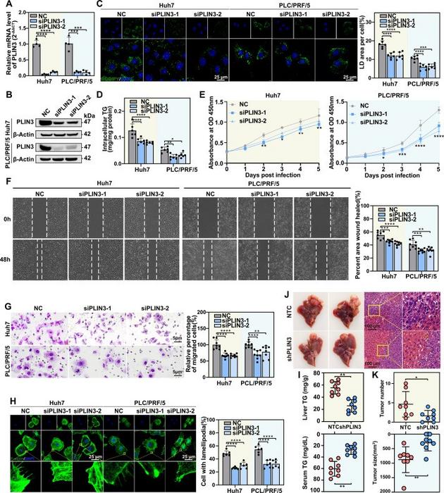 PLIN3 knockdown inhibits hepatocellular carcinoma cell proliferation and migration.