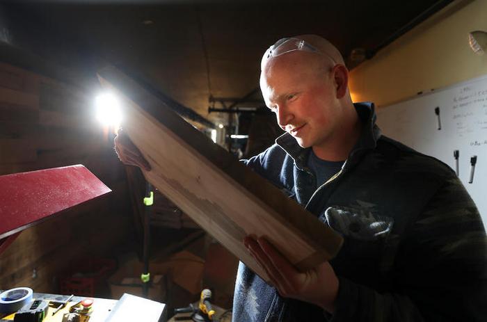 From drive-thru to OR: a twisted tale of UK patient's rare condition, complex surgery